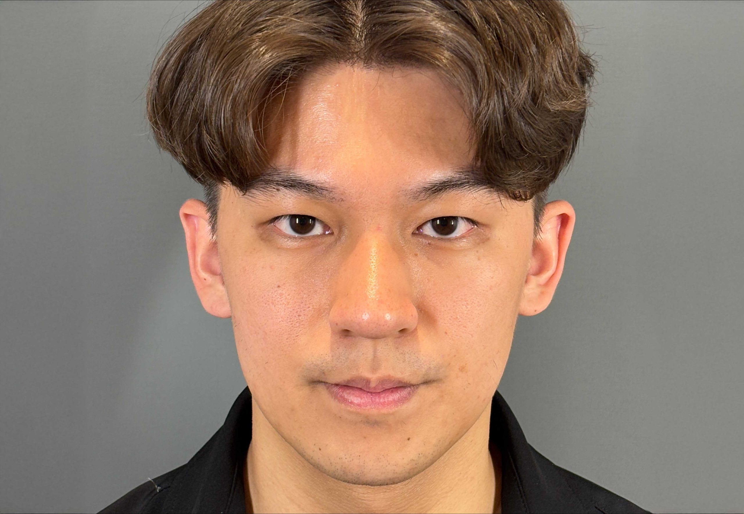 After image alt