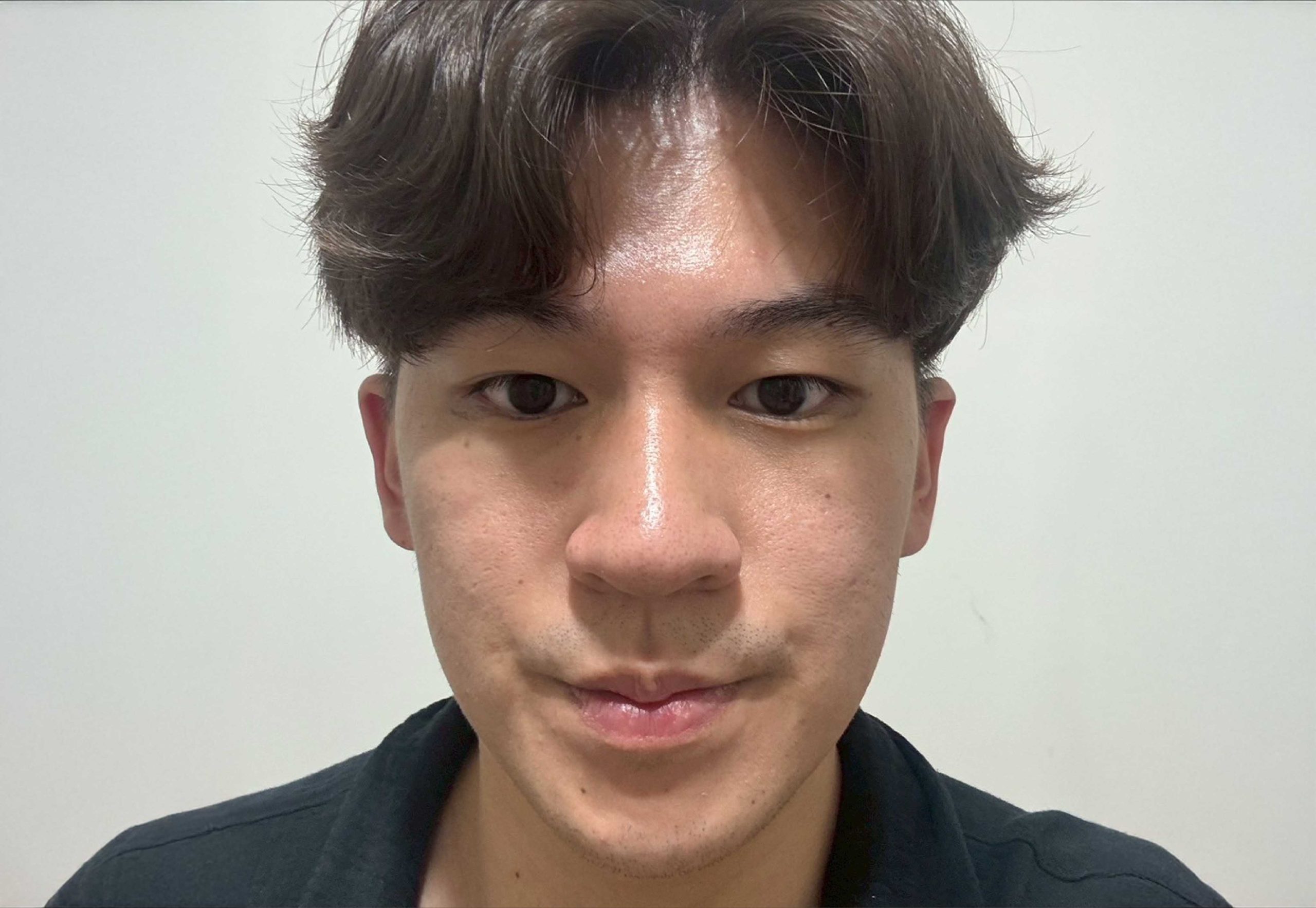 Before image alt