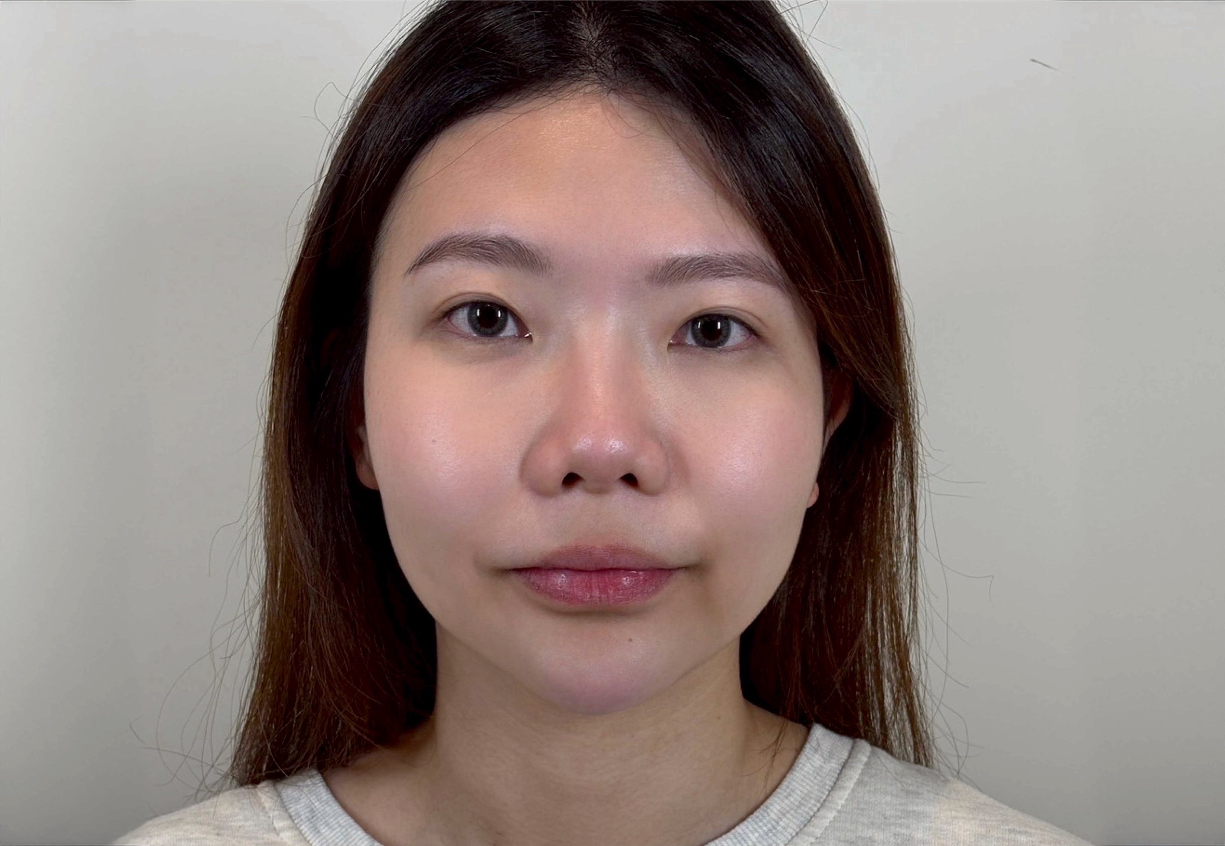 After image alt