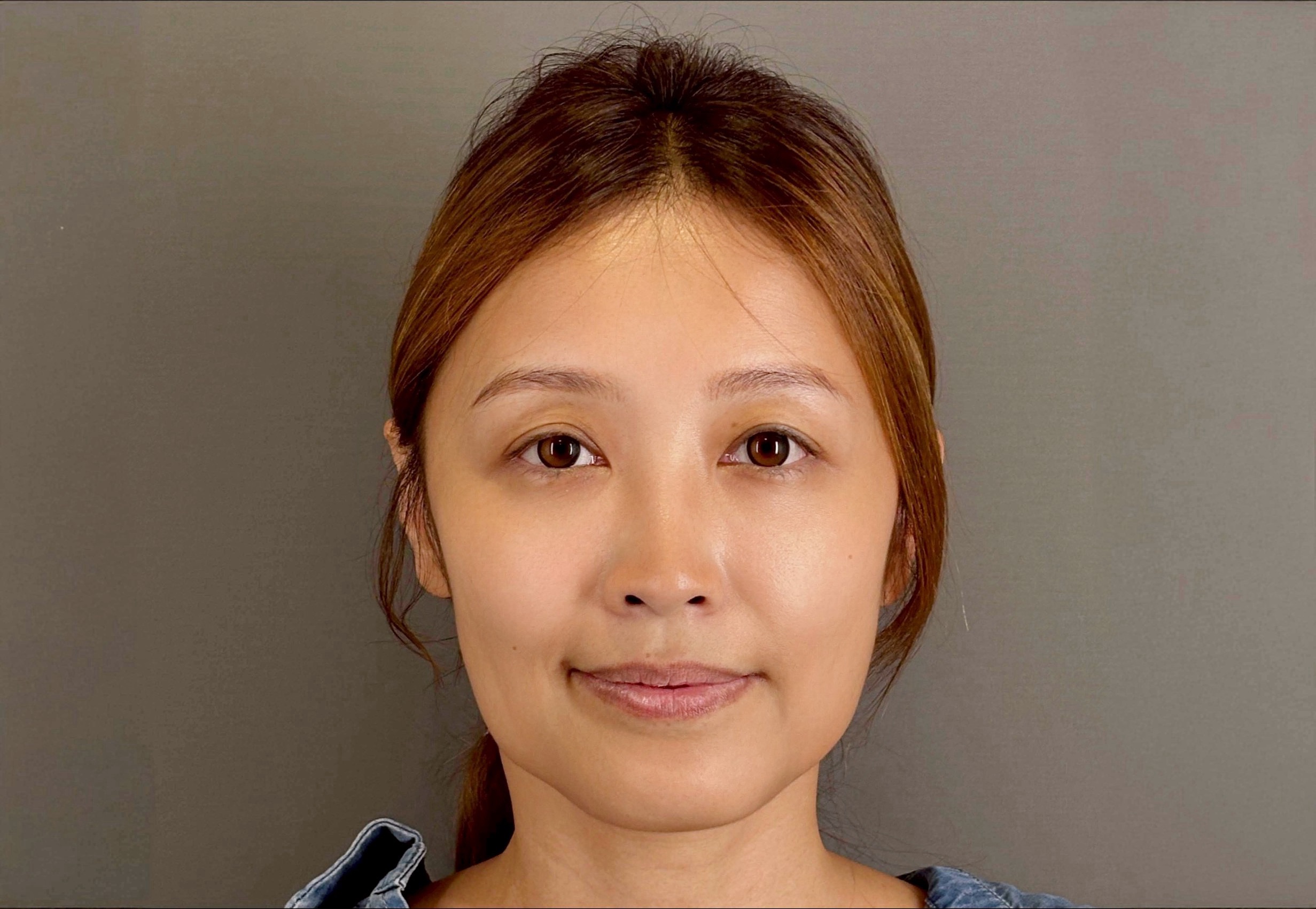 Before image alt