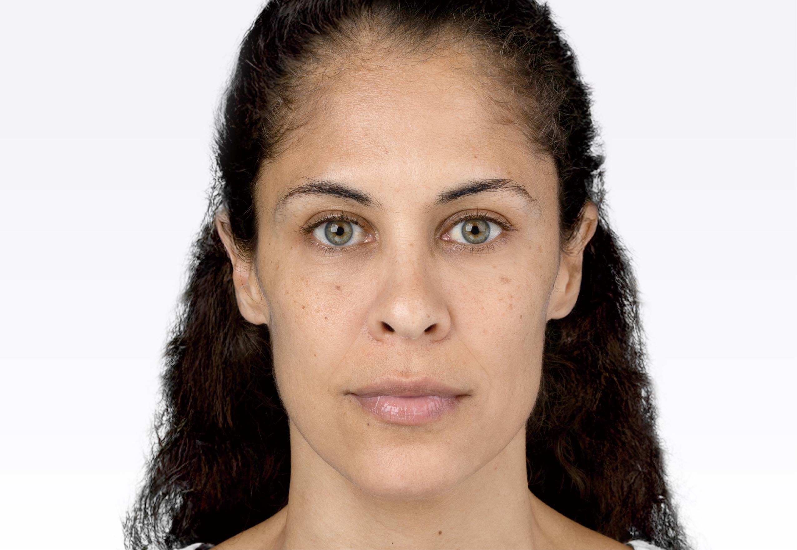 After image alt