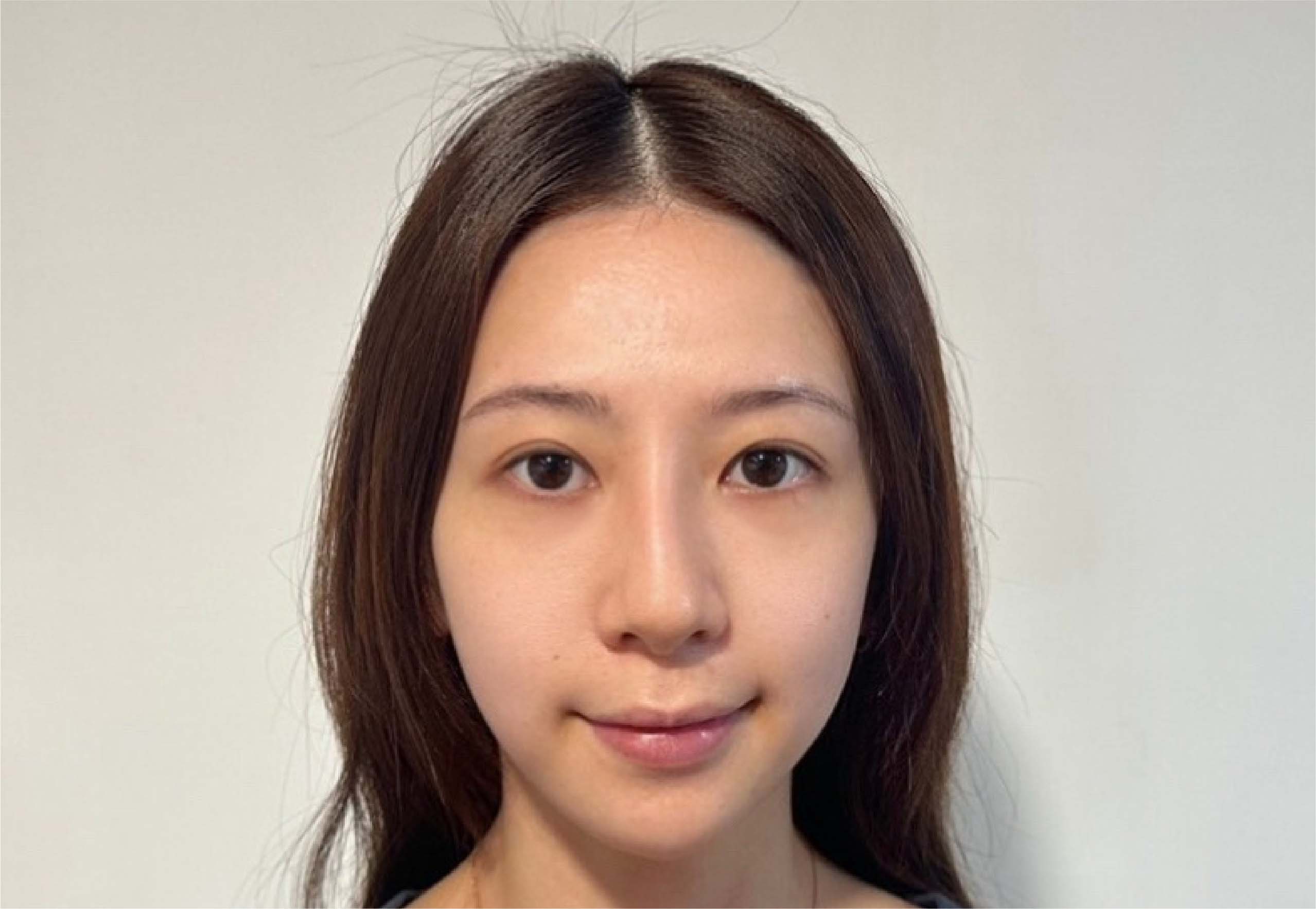 After image alt