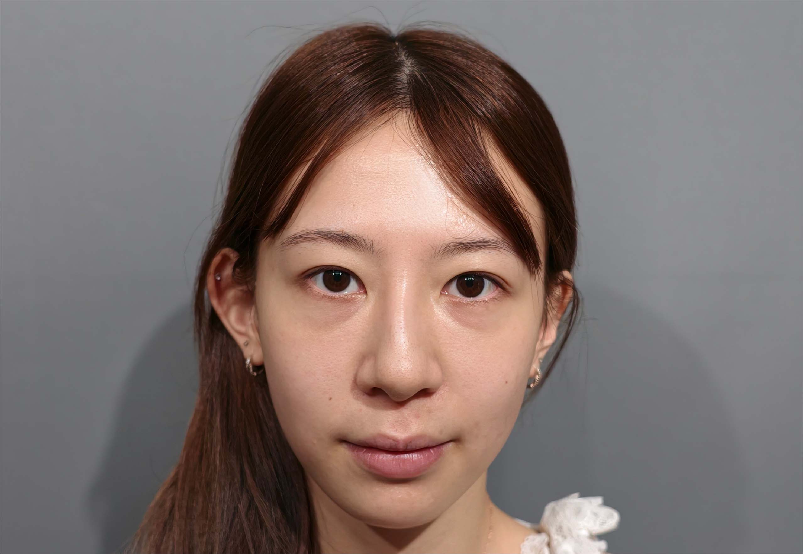 Before image alt